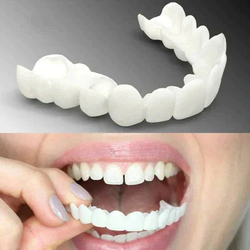 Facetas Odontológicas Removíveis